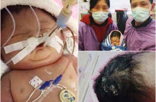 求剖腹遭拒　高齡媽轟聯院吸盤催生累B女亡